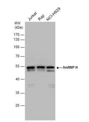 Western Blot: hnRNP H Antibody [NBP1-31648]