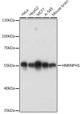 Western Blot: hnRNP H AntibodyAzide and BSA Free [NBP2-93590]