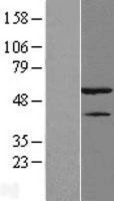 Western Blot: hnRNP H Overexpression Lysate [NBL1-11643]