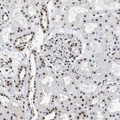 Immunohistochemistry-Paraffin: hnRNP H2 Antibody [NBP1-89816]