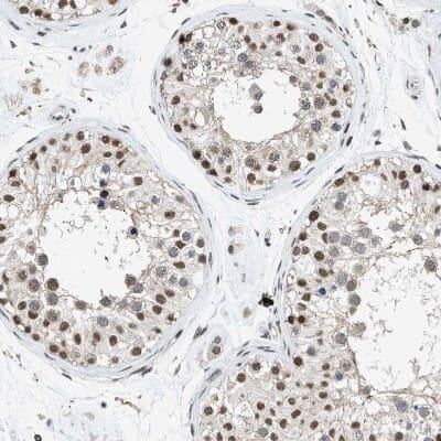 Immunohistochemistry-Paraffin: hnRNP H2 Antibody [NBP1-89816]