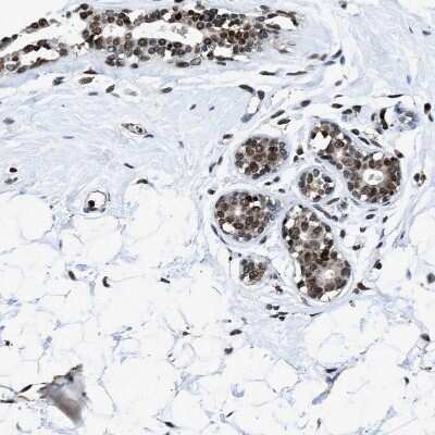 Immunohistochemistry-Paraffin: hnRNP H2 Antibody [NBP1-89816]