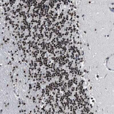 Immunohistochemistry-Paraffin: hnRNP H2 Antibody [NBP1-89816]