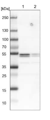 Western Blot: hnRNP H2 Antibody [NBP1-89817]