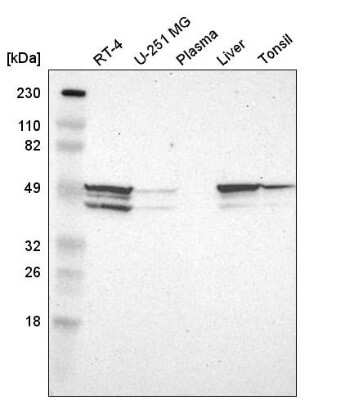 Western Blot: hnRNP H2 Antibody [NBP2-55194]