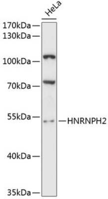 Western Blot: hnRNP H2 AntibodyAzide and BSA Free [NBP3-03568]