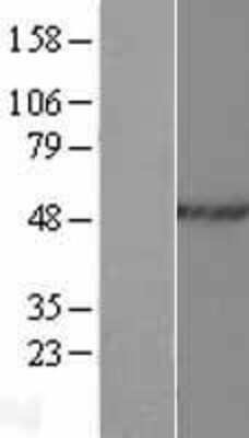 Western Blot: hnRNP H2 Overexpression Lysate [NBP2-06712]