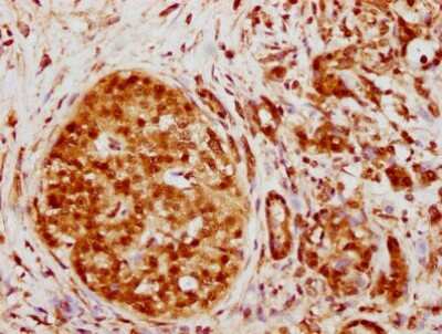 Immunohistochemistry: hnRNP K Antibody (3G7) [NBP3-15177]