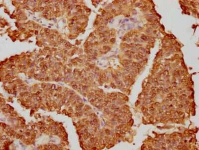 Immunohistochemistry: hnRNP K Antibody (3G7) [NBP3-15177]