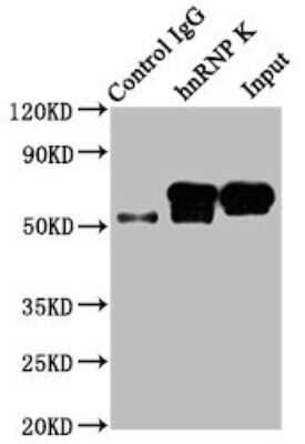 Immunoprecipitation: hnRNP K Antibody (3G7) [NBP3-15177]