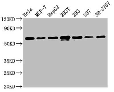 Western Blot: hnRNP K Antibody (3G7) [NBP3-15177]