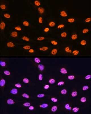 Immunocytochemistry/ Immunofluorescence: hnRNP K Antibody (3O5Y4) [NBP3-15303]