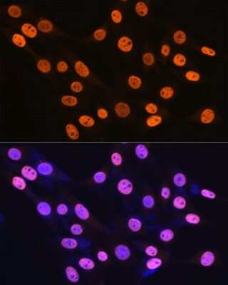 Immunocytochemistry/ Immunofluorescence: hnRNP K Antibody (3O5Y4) [NBP3-15303]