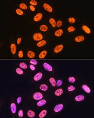 Immunocytochemistry/ Immunofluorescence: hnRNP K Antibody (3O5Y4) [NBP3-15303]