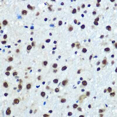 Immunohistochemistry-Paraffin: hnRNP K Antibody (3O5Y4) [NBP3-15303]