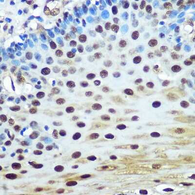 Immunohistochemistry-Paraffin: hnRNP K Antibody (3O5Y4) [NBP3-15303]