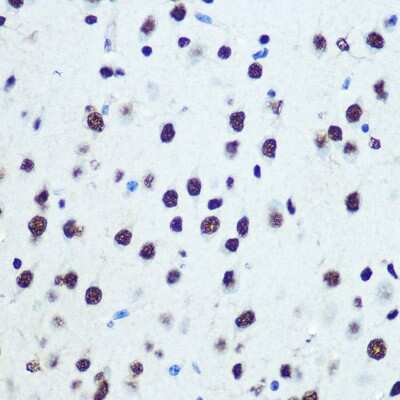 Immunohistochemistry-Paraffin: hnRNP K Antibody (3O5Y4) [NBP3-15303]