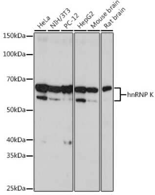 Western Blot: hnRNP K Antibody (3O5Y4) [NBP3-15303]