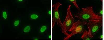 Immunocytochemistry/ Immunofluorescence: hnRNP K Antibody [NBP1-30975]