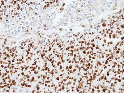 Immunohistochemistry-Paraffin: hnRNP K Antibody [NBP1-30975]