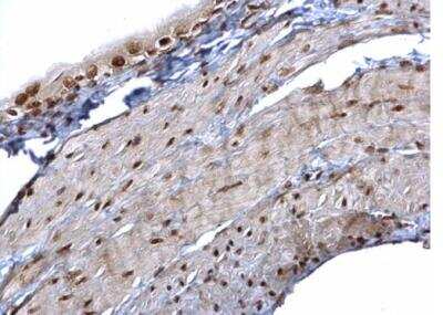 Immunohistochemistry-Paraffin: hnRNP K Antibody [NBP1-30975]
