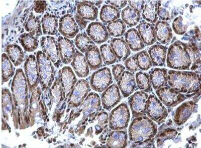 Immunohistochemistry-Paraffin: hnRNP K Antibody [NBP1-30975]