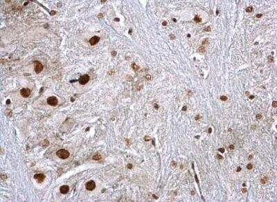 Immunohistochemistry-Paraffin: hnRNP K Antibody [NBP1-30975]