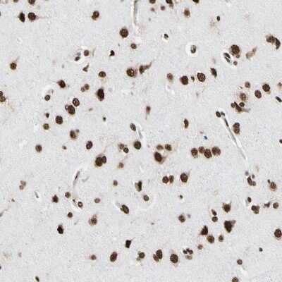 Immunohistochemistry-Paraffin: hnRNP K Antibody [NBP1-84374]