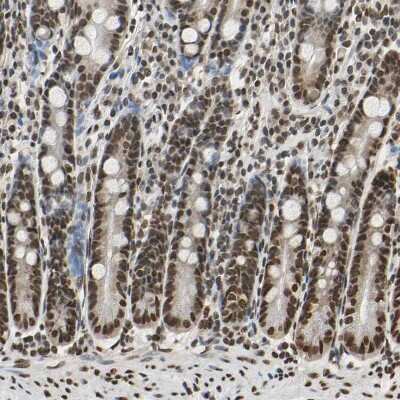Immunohistochemistry-Paraffin: hnRNP K Antibody [NBP1-84374]