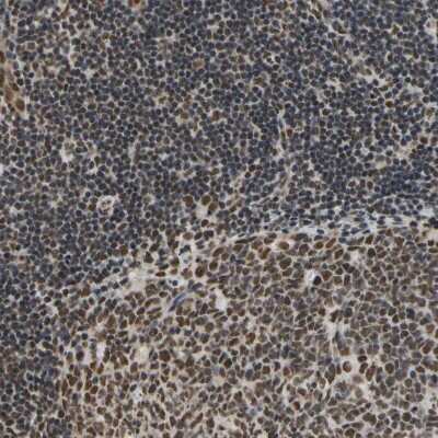 Immunohistochemistry-Paraffin: hnRNP K Antibody [NBP1-84374]