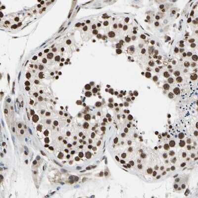 Immunohistochemistry-Paraffin: hnRNP K Antibody [NBP1-84374]