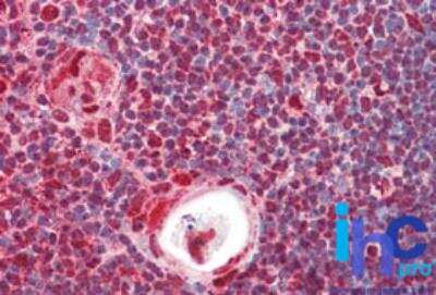 Immunohistochemistry-Paraffin: hnRNP K Antibody [NBP2-24531]