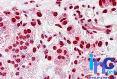 Immunohistochemistry-Paraffin: hnRNP K Antibody [NBP2-24531]