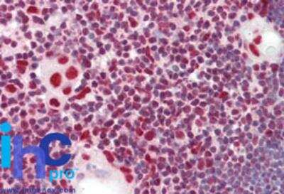 Immunohistochemistry-Paraffin: hnRNP K Antibody [NBP2-24532]