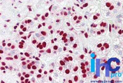 Immunohistochemistry-Paraffin: hnRNP K Antibody [NBP2-24532]