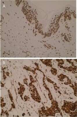 Immunohistochemistry: hnRNP K Antibody (N10 P2D3*G2) - BSA Free [NBP2-50424]