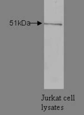 Western Blot: hnRNP K Antibody (N10 P2D3*G2)BSA Free [NBP2-50424]