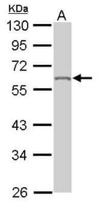 Western Blot: hnRNP K Antibody [NBP1-30975]