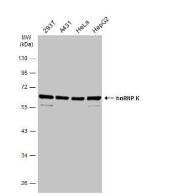 Western Blot: hnRNP K Antibody [NBP1-30975]