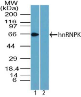 Western Blot: hnRNP K Antibody [NBP2-24531]