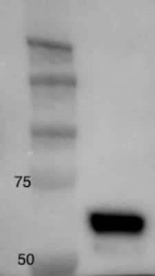 Western Blot: hnRNP K Antibody [NBP2-24531]