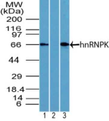 Western Blot: hnRNP K Antibody [NBP2-24532]