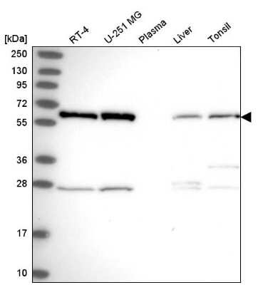 Western Blot: hnRNP K Antibody [NBP2-58067]