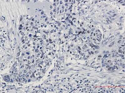Immunohistochemistry-Paraffin: hnRNP K/J Antibody (S07-5H0) [NBP3-14943]