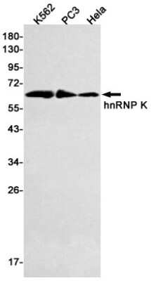 Western Blot: hnRNP K/J Antibody (S07-5H0) [NBP3-14943]