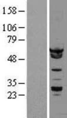 Western Blot: hnRNP K Overexpression Lysate [NBL1-11645]