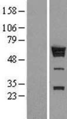 Western Blot: hnRNP K Overexpression Lysate [NBL1-11647]