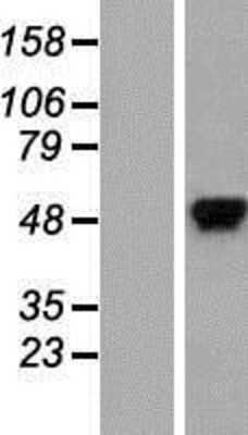 Western Blot: hnRNP K Overexpression Lysate [NBP2-06147]