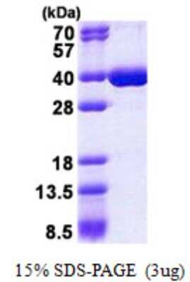 SDS-PAGE: Recombinant Human hnRNP K His Protein [NBP2-23120]