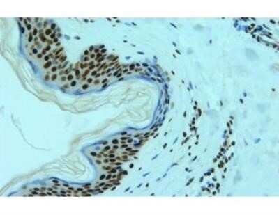 Immunohistochemistry: hnRNP L Antibody (4D11) - Azide and BSA Free [NBP2-80778]